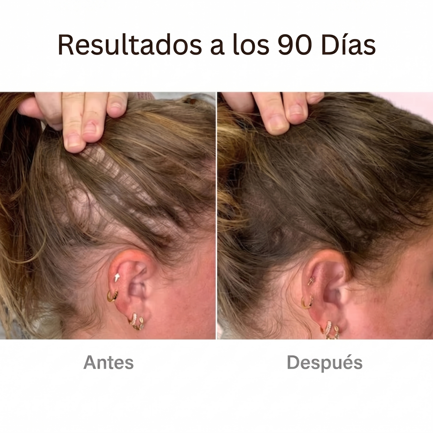 Cepillo de Terapia Capilar | Capilux