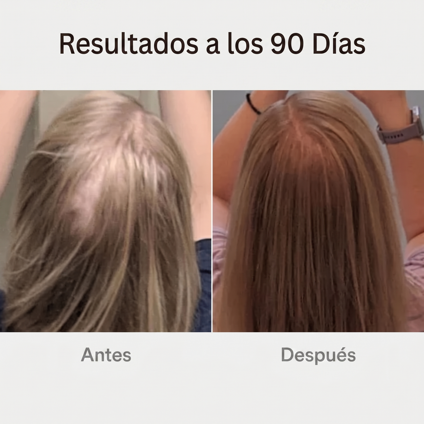Cepillo de Terapia Capilar | Capilux